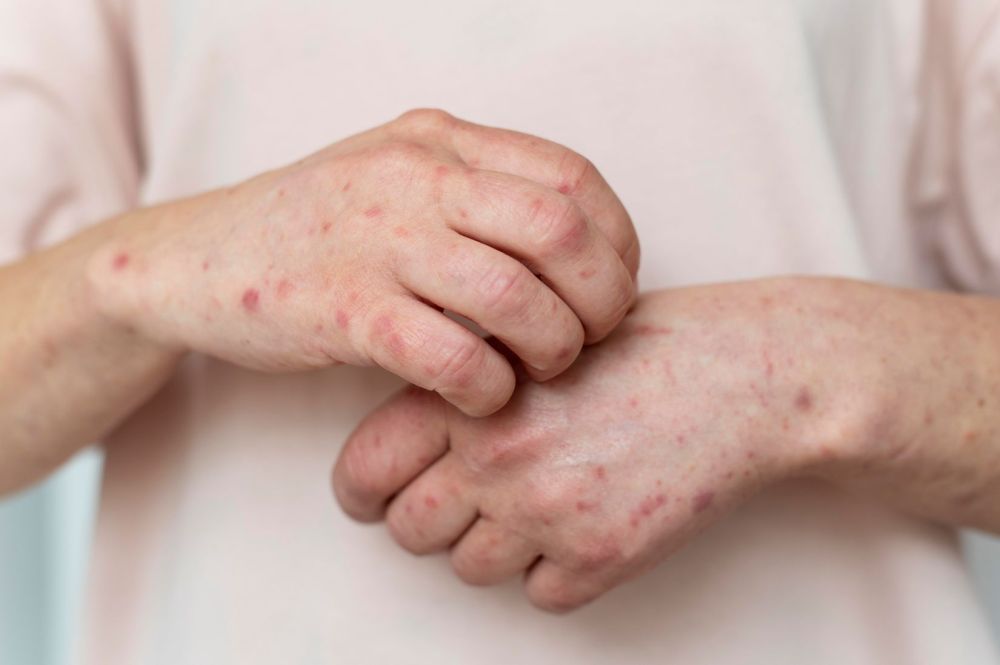 Measles rash on young person's arms