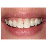 Smile showing teeth